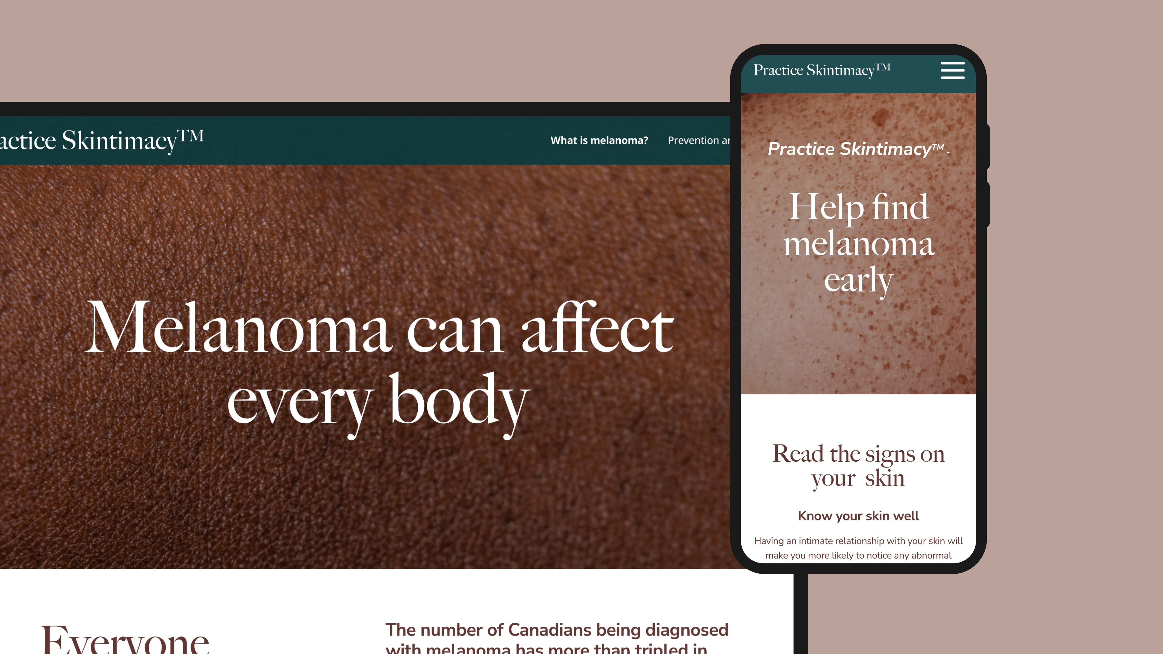 Practice Skintimacy website on Desktop and mobile showing one of the key messaging: Melanoma can affect every body.